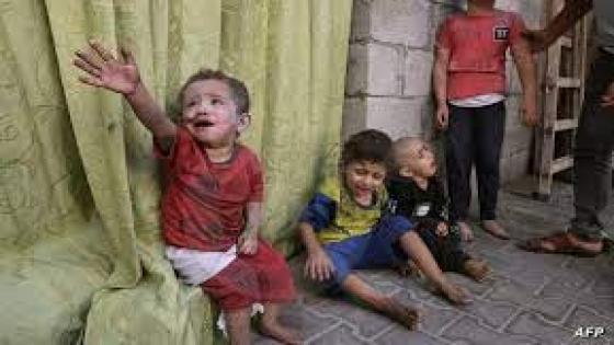 سوء الأوضاع الصحية أطفال غزة